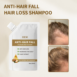 Champú orgánico anticaída de cabello, Etiqueta Privada, venta al por mayor, hidratante, nutritivo, engrosamiento, anticaída, crecimiento del cabello para hombres <span class=keywords><strong>y</strong></span> mujeres - Product Image 3