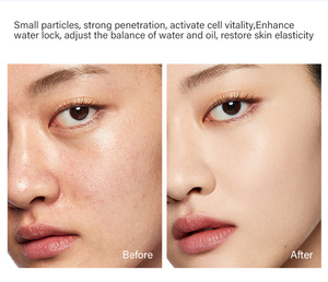 New 2 trong 1 Hydra cao áp Oxy máy bay phản lực mặt máy bác sĩ nước-hiệu quả oxy phun điều trị - Product Image 3