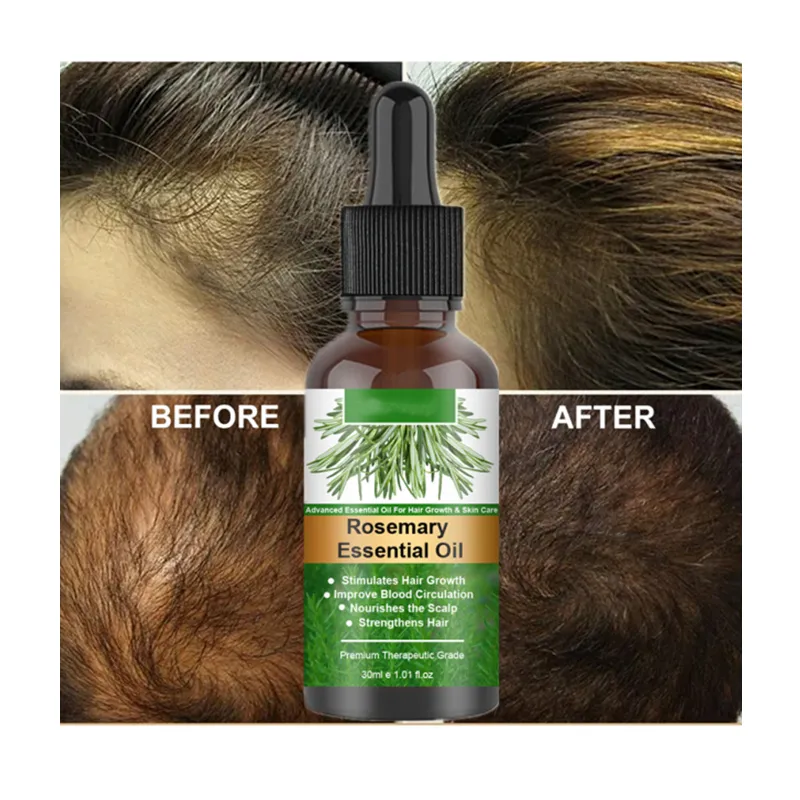 Rosemary nourrissant promouvoir les soins capillaires brillant Anti perte de cheveux croissance rapide 100% croissance des cheveux purs sérum d'huile essentielle de romarin