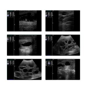 Periodieke Draagbare Medische Veterinaire Echografie Apparatuur Dier Echografie Scanner - Product Image 6