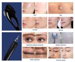 Máquina Portátil 2 en 1 Multifuncional de Depilación y Eliminación de Tatuajes con Láser Pico IPL E-light Magnético de 360° - Product Image 6