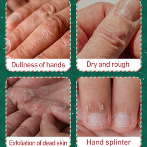 卸売 クリスマス ハンドクリーム セット、秋冬の乾燥した手のための保湿栄養ハンドクリーム5点セット、ギフトセット - Product Image 6