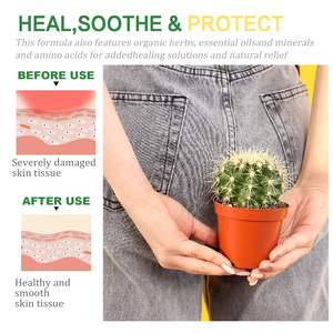 Extractos Naturales de Plantas para el Alivio del Dolor Anal, Crema Ungüento para el Tratamiento del Prurito y las Hemorroides, 20g - Product Image 4