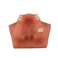Modèle de pratique de placement d'implant de levage de sinus dentaire B modèle de formation d'implant de base pratique gencives molles dent de formation dentaire