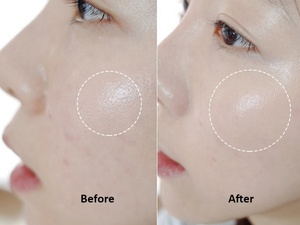 Macing — maquillage <span class=keywords><strong>peau</strong></span> <span class=keywords><strong>grasse</strong></span> organique, maquillage de luxe pour le visage, sans cruauté pour les animaux - Product Image 6