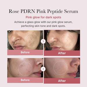 Sérum Peptidique Rose PDRN Anti-Âge à l'ADN de Saumon pour la Réparation et le Raffermissement de la Peau, Marque Privée, 30ml - Product Image 2