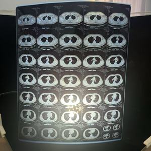 <span class=keywords><strong>Film</strong></span> laser radiographique médical, taille 14x17, bleu, personnalisable, haute qualité, matériau PET transparent, épaisseur 175, adhésif pour l'emballage - Product Image 5