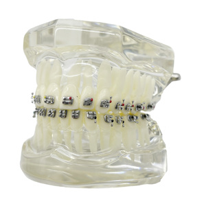 Yamei ortodontico 10000set a buon mercato tipo caldo dentale ortodontico Roth staffa Roth MBT Edgewise Wire taglio staffe (20 pz/carta) - Product Image 5