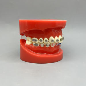 แบบจำลองการแสดงผลอุปกรณ์จัดฟันอุปกรณ์จัดฟันเครื่องช่วยสอนเปรียบเทียบโลหะ/เซรามิกสำหรับการสื่อสารระหว่างแพทย์คลินิกโรงพยาบาลผู้ป่วย - Product Image 2