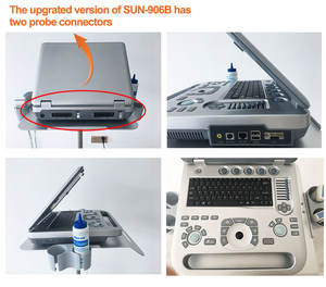 15 Inch Professionele Cardiale Kleur Doppler Tdi Echografie Ziekenhuis Cardioloog Echografie - Product Image 4