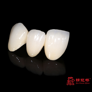 Couronne et ponts personnalisables en céramique de porcelaine à haute résistance de zircone pour les <span class=keywords><strong>dents</strong></span> antérieures et postérieures - Product Image 5