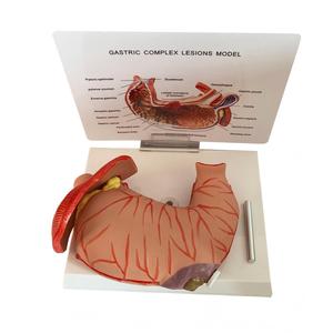 แบบจำลองการเปลี่ยนแปลงของกระเพาะอาหารในมนุษย์ สำหรับการสอนทางการแพทย์ด้านโรค<span class=keywords><strong>กระเพาะ</strong></span>อาหารและระบบทางเดินอาหาร - Product Image 5