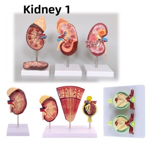 Modelo Anatómico de Riñón con Glándulas Adrenales Ampliadas, Riñones Patológicos, Anatomía Visceral Humana, Material PVC, MAXCARE MAC-L27 - Product Image 5