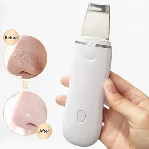 Visage beauté soins de santé nettoyage du visage épurateur de peau visage peau spatule dissolvant de points noirs Machine à éplucher à ultrasons profond