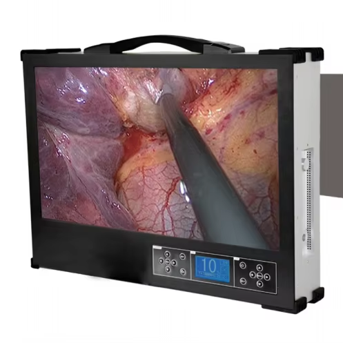 Portable Small Mini Integrated Endoscopy Camera System for Ent Laparoscopy Hysteroscope Ureteroscope Fiberscope