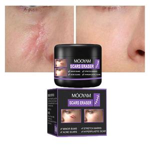 ครีมลบรอยแผล<span class=keywords><strong>เป็น</strong></span>จากสิว รอยแตกลาย ครีมลดรอยแผล<span class=keywords><strong>เป็น</strong></span>หลังผ่าตัด ครีมกระชับสัดส่วน - Product Image 1