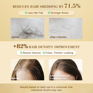 Sérum Anti-Chute de Cheveux en Gros 50ml – Essence Dorée Équilibre Eau-Huile – Combat le Vieillissement du Cuir Chevelu et Revitalise les Follicules Capillaires - Product Image 5