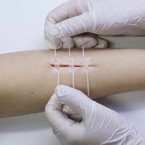 Màng PU Trong Suốt Đóng Cửa Dây Kéo Đóng Cửa Dây Kéo Cho Vết Rách - Product Image 3