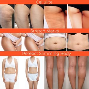 Crème Chaude Anti-Cellulite Lance ODMOEM Raffermissante et Amincissante pour le Corps, le Ventre, la Taille et les Fesses – Brûleur <span class=keywords><strong>de</strong></span> <span class=keywords><strong>Graisse</strong></span> Abdominale - Product Image 5