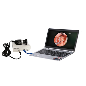 Cámara de Endoscopia Médica para Oído, <span class=keywords><strong>Nariz</strong></span> <span class=keywords><strong>y</strong></span> <span class=keywords><strong>Garganta</strong></span> - Product Image 1