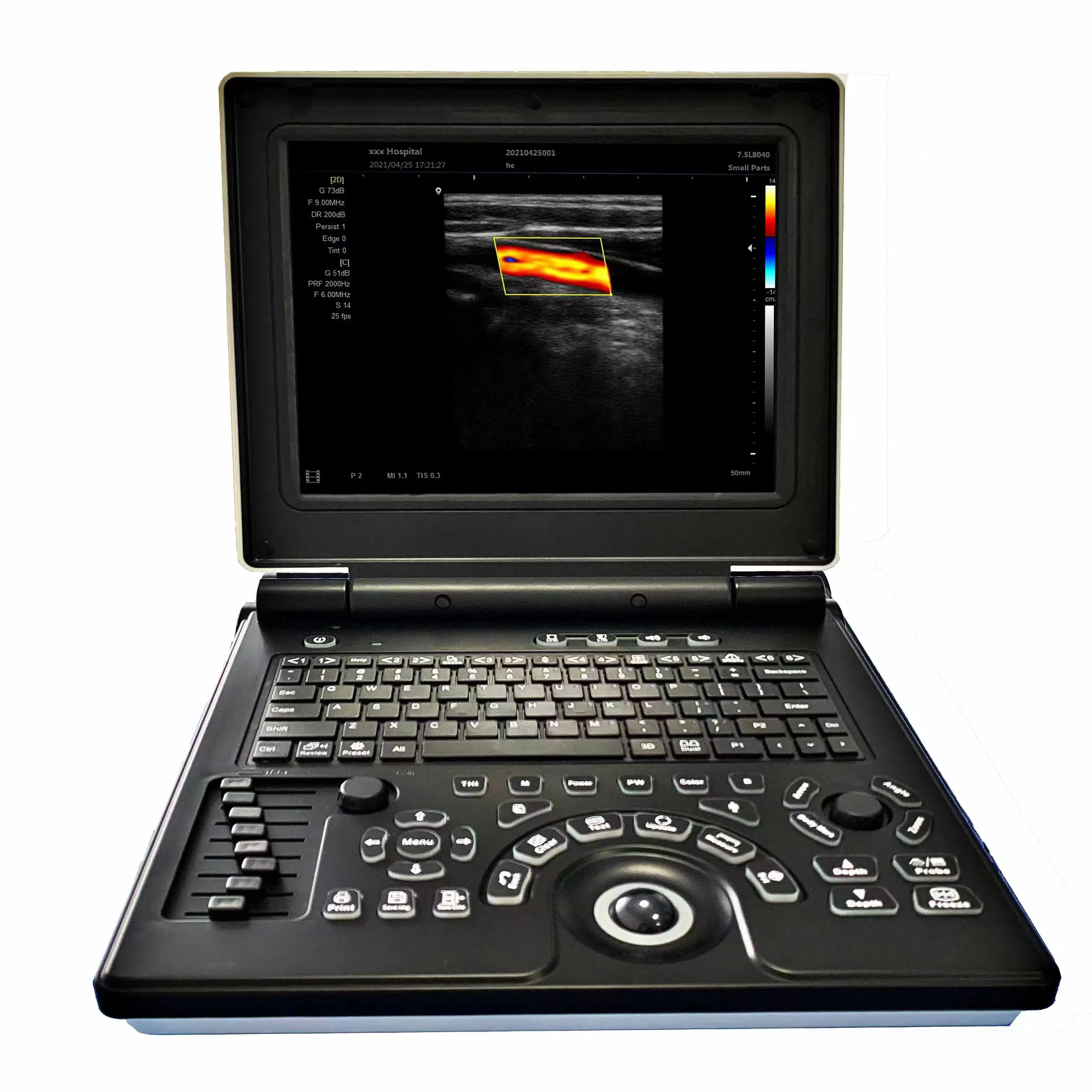 MECAN Echocardiography Laptop Notebook 3D 4D Software Color Doppler Ultrasound Machine Human Vet