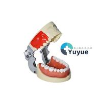 Modèle d'entraînement dentaire à 28 dents amovibles, gencives en silicone souple, base à charnière métallique, pour la pratique et l'enseignement des implants dentaires