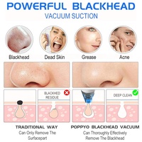 Visage enlever les pores acné aspiration nettoyant dissolvant visage beauté points noirs aspirateur extracteur outils Kits