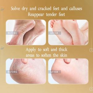 Masque <span class=keywords><strong>pour</strong></span> les pieds AESTHTANY 40g, traitement réparateur hydratant, miel, lavande, noix de coco, rétinol, peptide, beurre de karité, parfum frais <span class=keywords><strong>pour</strong></span> femmes - Product Image 4