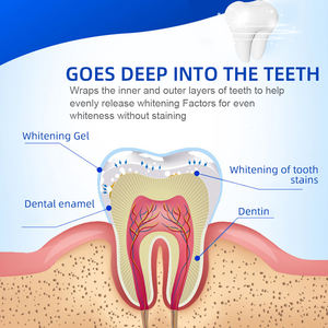 28 Piezas de Accesorios de Blanqueamiento Dental Multiusos de Alta Calidad, Gel de Recarga para Uso Doméstico, Barrera Gingival de Grado Alimenticio, Carillas Dentales - Product Image 6
