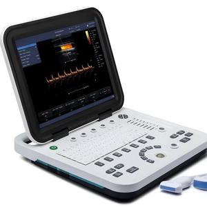 Ecógrafo Doppler Color Veterinario KU1 de 15 Pulgadas con Sonda Dual y Batería Integrada para Ganado, Caballos, Perros, Gatos y Ovejas - Product Image 1