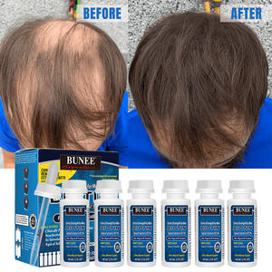 Productos calientes Solución tópica para hombres Tratamiento antipérdida de cabello Aceite para el crecimiento del cabello Suero de biotina Kirland crecimiento del cabello - Product Image 3