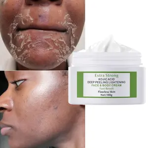 60/100g Customized Extra Strong Kojic Acid 7days Lightening Peeling Face Body Cream Whitening Cream