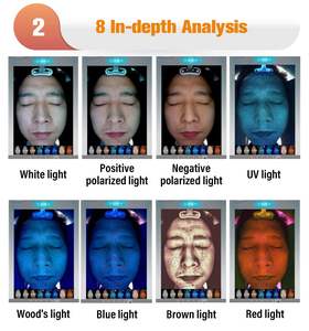 معدات Dermatoscope Ai الذكية ثلاثية الأبعاد لتشخيص الصور الرقمية - Product Image 5