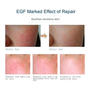 เซรั่มมารียา  สารเร่งการเจริญเติบโตของผิวหนัง (EGF)  บำรุงผิว ลดรอยสิว ริ้วรอย จุดด่างดำ ฟื้นฟูผิว กระชับผิว - Product Image 2
