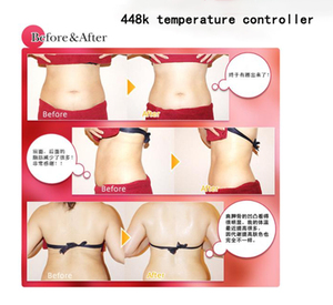 Máquina de Belleza Multifuncional 448K para Reafirmar la Piel, Reducir Grasa y Desintoxicar Linfáticamente para Uso Comercial - Product Image 6