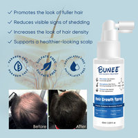 Spray de croissance des cheveux 60 ml, Pousse Cheveux, huile essentielle de romarin, sérum de croissance des cheveux à la biotine, spray pour femmes et hommes