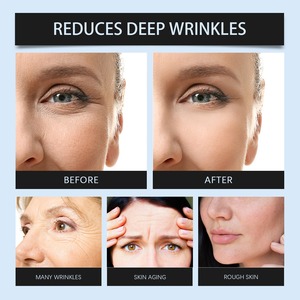 Sérum réparateur pour le visage nourrissant en profondeur Meilleur sérum anti-âge anti-rides personnalisé en gros - Product Image 6