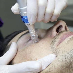 ตลับหมึกสัก F7แบบเข็ม DR PEN A6 microneedling Derma - Product Image 3