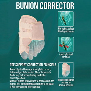Corrector <span class=keywords><strong>de</strong></span> <span class=keywords><strong>Hallux</strong></span> Valgus, Férula para Juanetes con Correa Ajustable, <span class=keywords><strong>Separador</strong></span> Ortopédico <span class=keywords><strong>de</strong></span> Dedos para Alivio del Dolor y Alineación, Uso Diario - Product Image 4