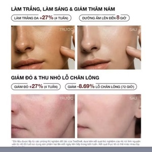 Suero Iluminador con Niacinamida Teashell 5% 30ml, Blanqueamiento Instantáneo para el Cuidado Facial - Product Image 4