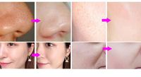 Máquina Facial con Tecnología Avanzada de Guangdong, Terapia de Oxígeno 7 en 1, Jet Peel para Clínicas de Cuidado de la Piel, Resultados de Grado Médico