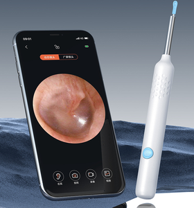 El Más Vendido: Removedor de <span class=keywords><strong>Cera</strong></span> de Oídos Inalámbrico, Herramienta Eléctrica para la Eliminación de <span class=keywords><strong>Cera</strong></span> con Otoscopio Visual y Cámara WiFi, Enchufe Estadounidense - Product Image 1