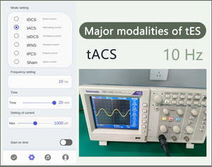 تي دي سي إس تي إيه سي إس سي إي إس تي آر إن إس |   التحفيز الكهربائي عبر الجمجمة لدعم صحة الدماغ - Product Image 4