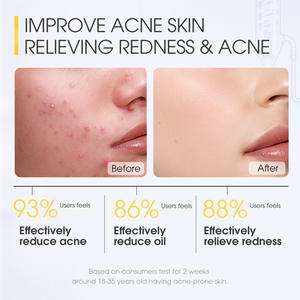 มา<span class=keywords><strong>ส</strong></span>ก์<span class=keywords><strong>หน้า</strong></span>บำรุงผิว<span class=keywords><strong>หน้า</strong></span>แบบพกพา20มล. ควบคุม<span class=keywords><strong>น</strong></span>้ำมั<span class=keywords><strong>น</strong></span>เจลซาลิไซลิกแอซิดสำหรับต้นชา<span class=keywords><strong>น</strong></span>้ำแข็งสูตรอ่อนโย<span class=keywords><strong>น</strong></span><span class=keywords><strong>ส</strong></span>ำหรับน้ำมั<span class=keywords><strong>น</strong></span>เซ<span class=keywords><strong>น</strong></span>เทลล่า" - Product Image 6