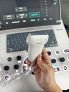 Appareils d'échographie médicale Mindray Consona N5 et échographie Doppler couleur Consona N5 pour usage vétérinaire - Product Image 5