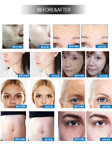 Pistola de Mesoterapia TAIBO, Indolora, Sin Agujas, No Invasiva, Inyector de Agua Facial de Escritorio, Cuidado de la Piel, Limpieza Facial, Máquina de <span class=keywords><strong>Spa</strong></span> - Product Image 2