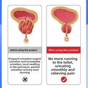 Parche Magnético Térmico Médico OEM para la Próstata, para Hombres, <span class=keywords><strong>Dolor</strong></span> Lumbar, Prostatitis, Hinchazón, Micción Frecuente, Incontinencia Urinaria - Product Image 4