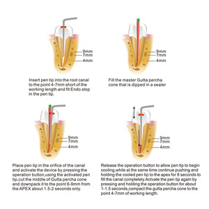 Großhandel Endodontisches Obturationssystem Kabelloses Metall-Guttapercha-Obturationsgerät mit Heizspitzen CE-Zertifiziert - Product Image 6
