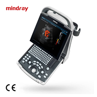 Machine à ultrasons numérique portable Mindray DP-30 Vet Scanner d'imagerie diagnostique vétérinaire noir et blanc