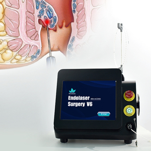 Láser de diodo Dual 980nm 1470nm Láser de hemorroidectomía para proctólogo/proctología - Product Image 3